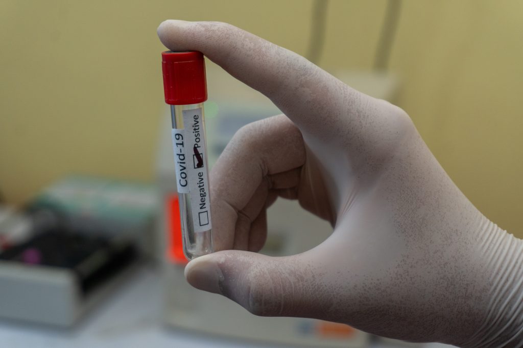 Venda de teste para coronavírus inicia na Panvel Farmácias