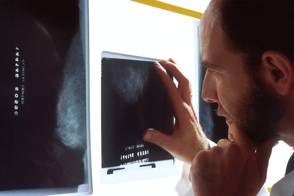 São esperados 65 mil novos casos de câncer de próstata no Brasil em 2020