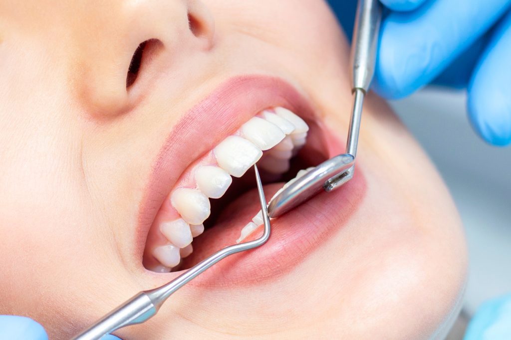 Planos de saúde odontológicos ultrapassam a marca de 30 milhões de vínculos no País